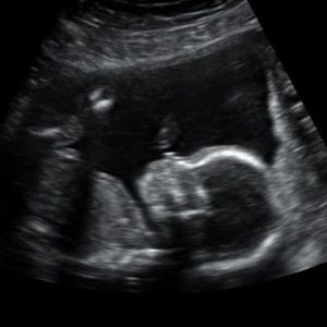 Meet your Posher, Ellen sue